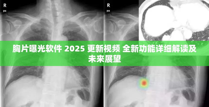 胸片曝光软件 2025 更新视频 全新功能详细解读及未来展望