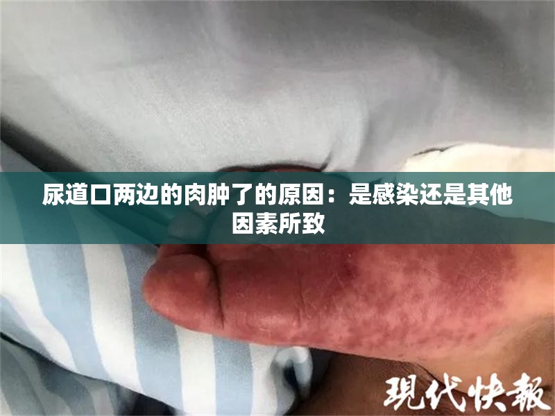 尿道口两边的肉肿了的原因：是感染还是其他因素所致