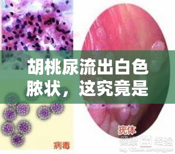 胡桃尿流出白色脓状，这究竟是怎么回事？