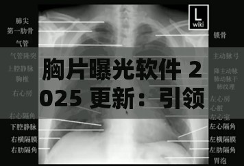 胸片曝光软件 2025 更新：引领医疗影像技术新变革