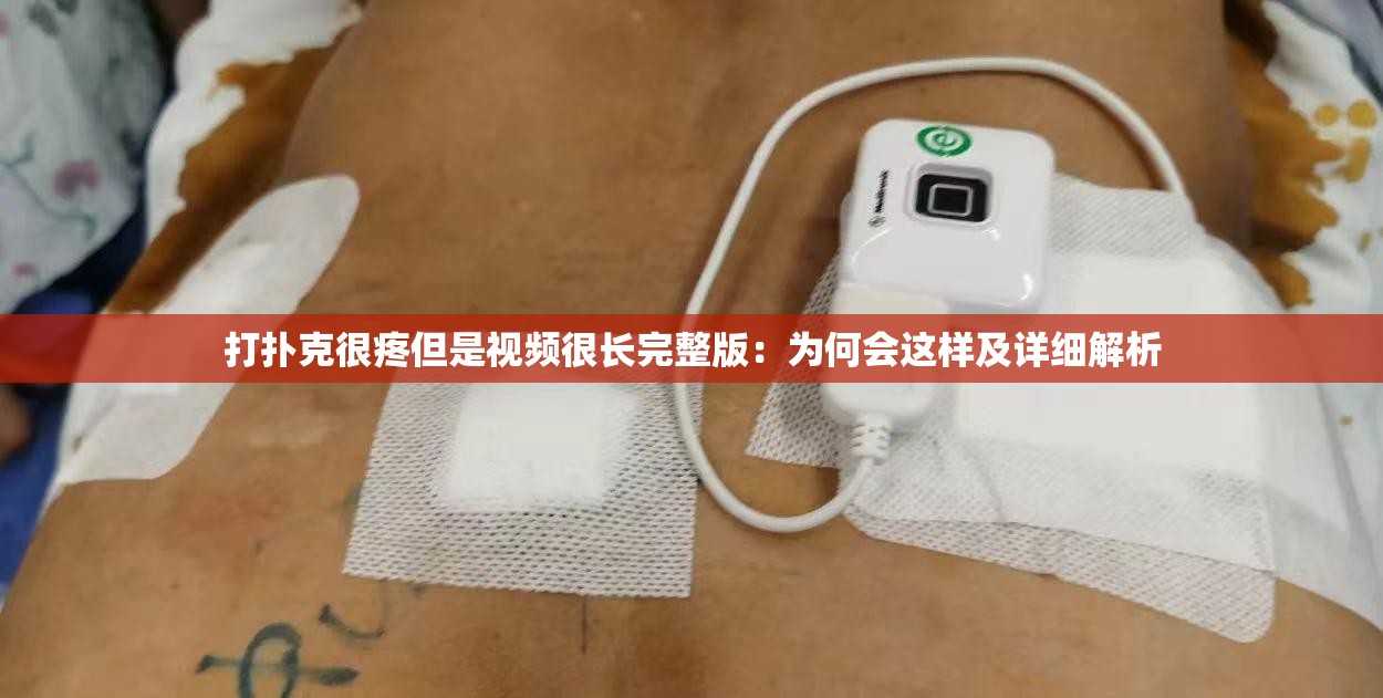 打扑克很疼但是视频很长完整版：为何会这样及详细解析