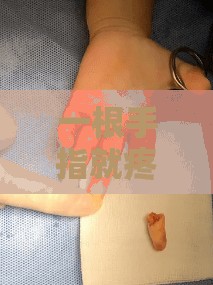 一根手指就疼了：这到底是怎么回事呢