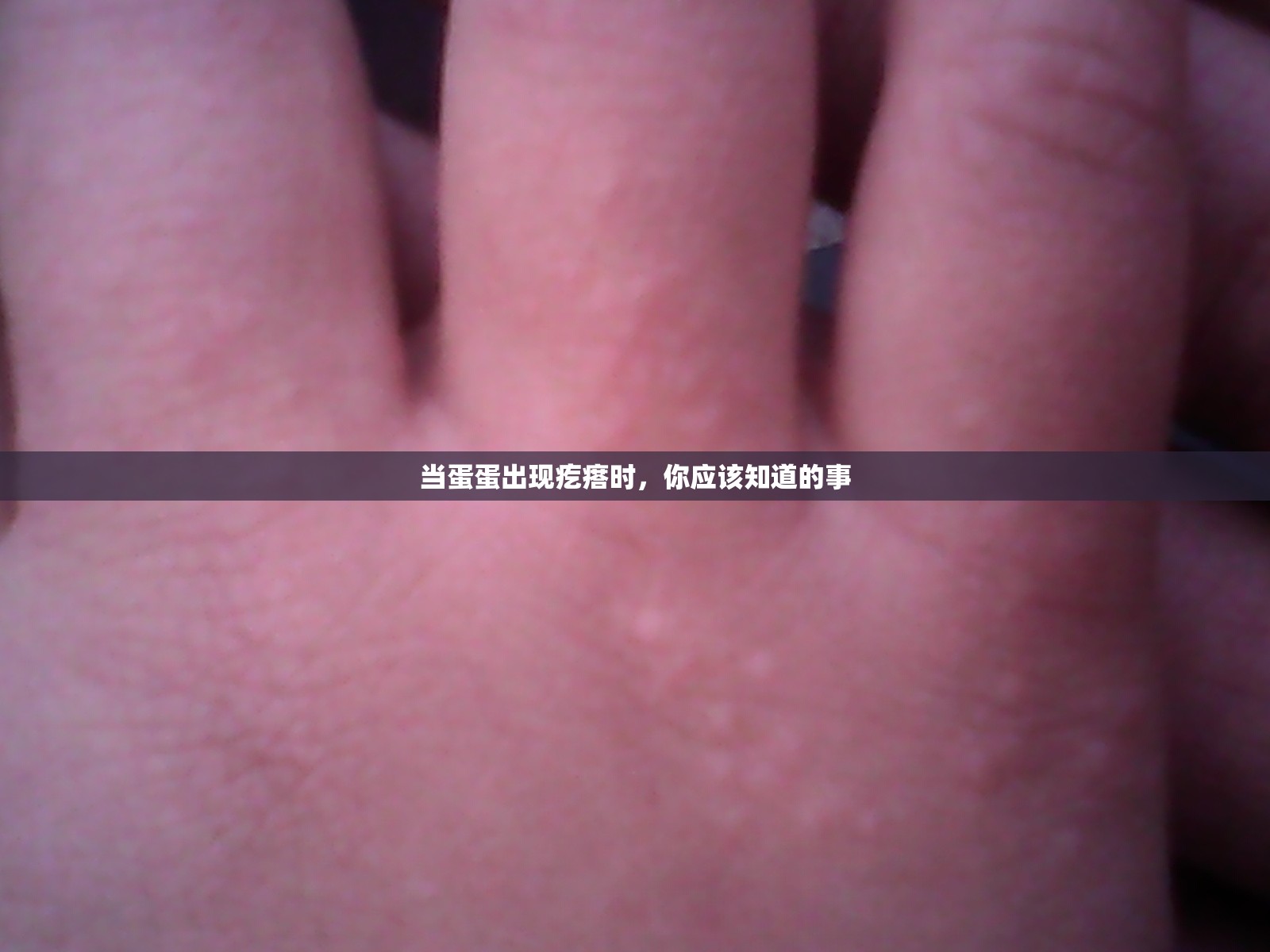 当蛋蛋出现疙瘩时，你应该知道的事