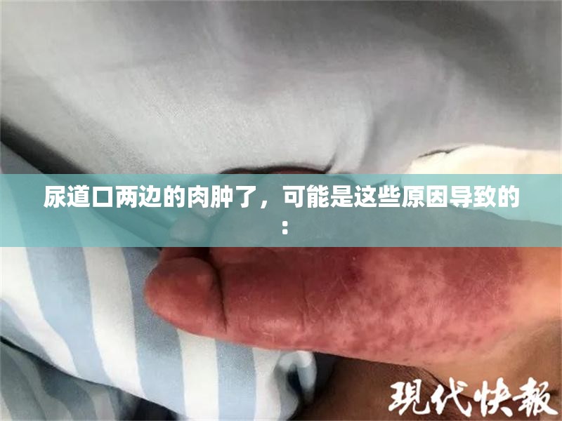 尿道口两边的肉肿了，可能是这些原因导致的：