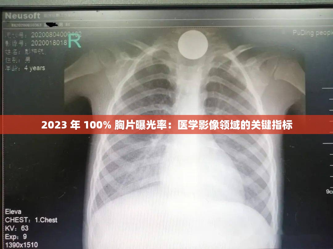 2023 年 100% 胸片曝光率：医学影像领域的关键指标
