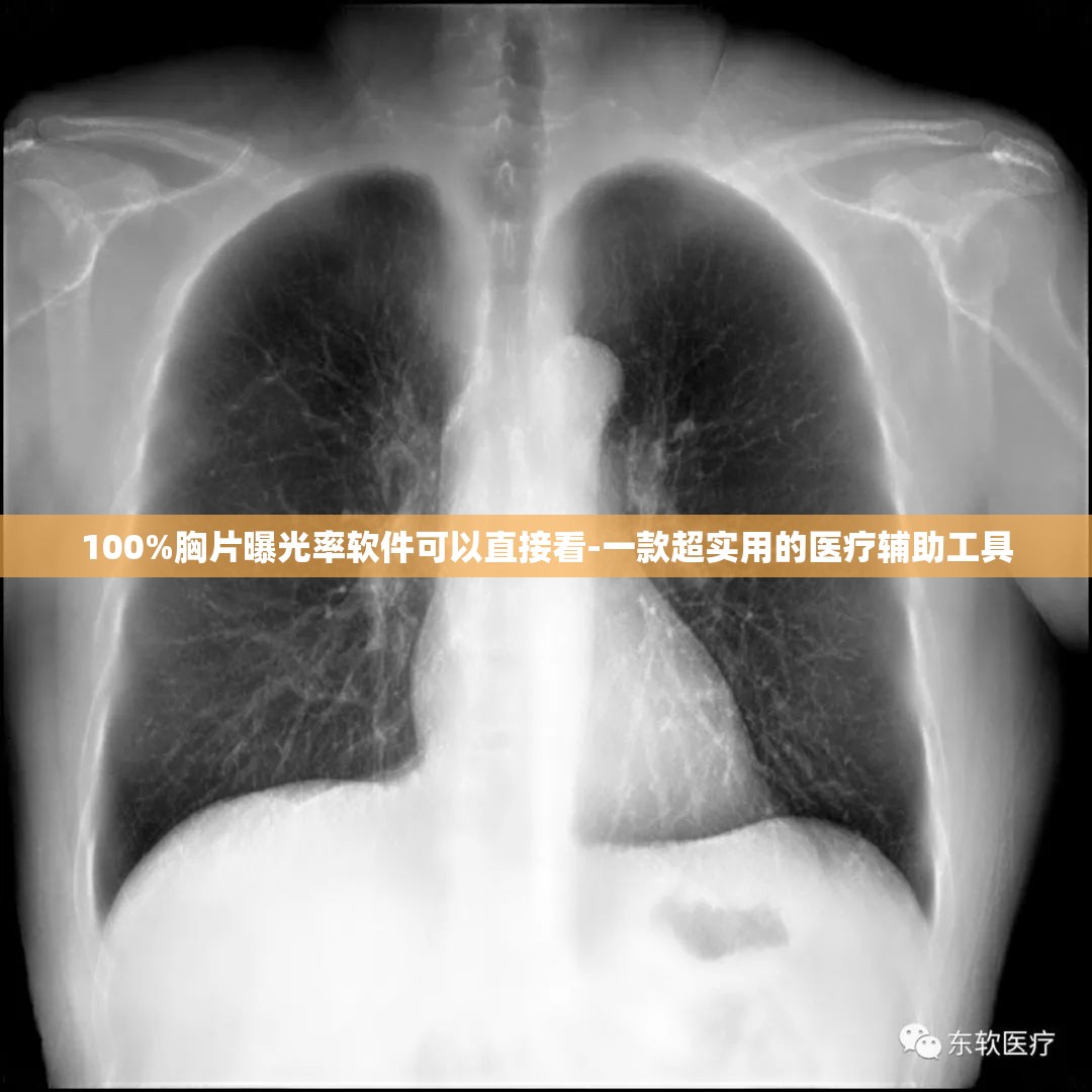 100%胸片曝光率软件可以直接看-一款超实用的医疗辅助工具