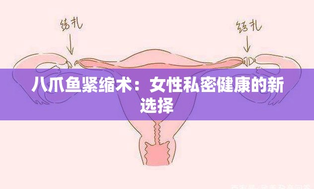 八爪鱼紧缩术：女性私密健康的新选择