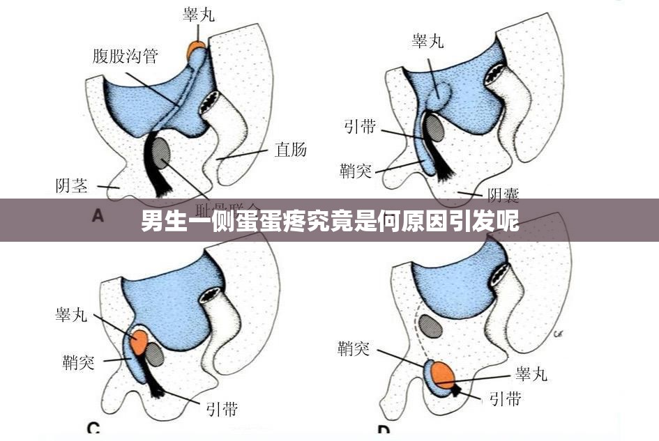 男生一侧蛋蛋疼究竟是何原因引发呢